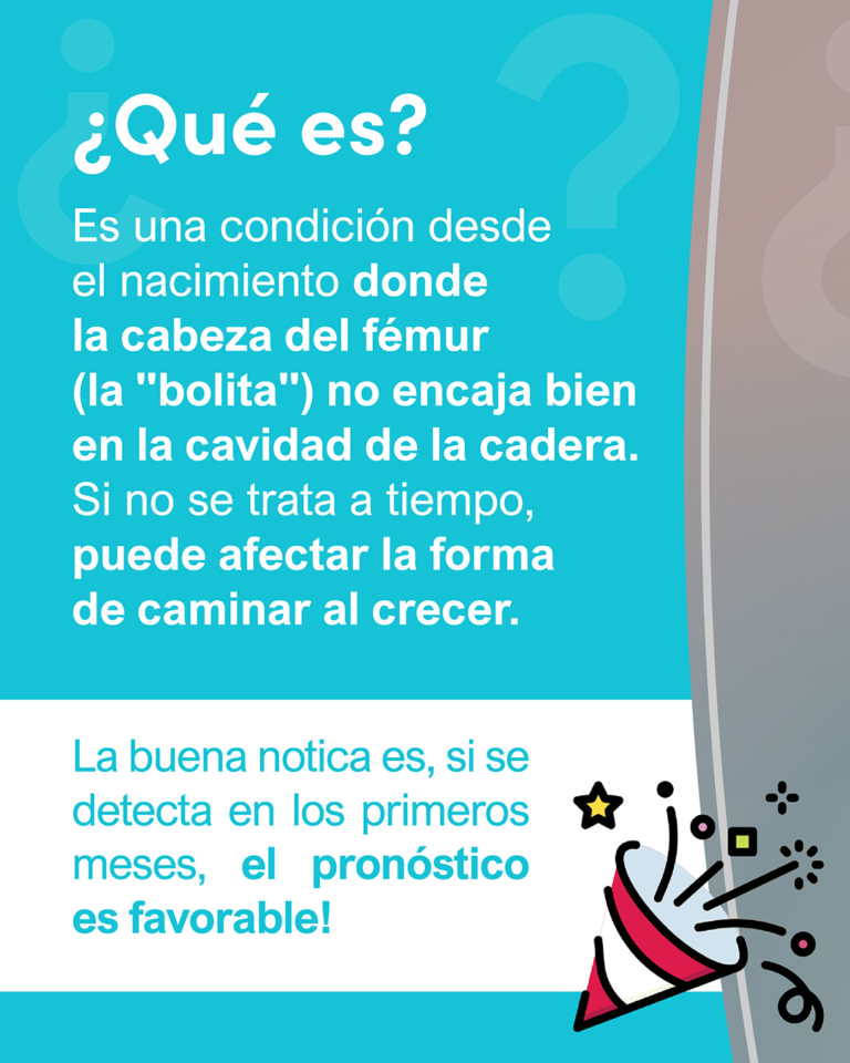 2 Displacia de caderas_2